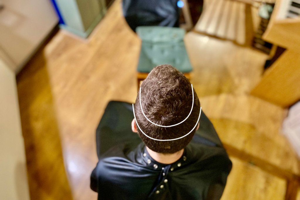 man's head pictured from the top with lines around his hair showing the hair lines to cut a man's hair with a tutorial